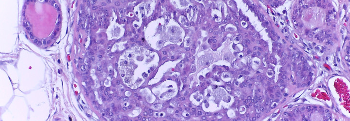 http://www.bioimaging2015.ineb.up.pt/banner_img/banner_Challenge.jpg